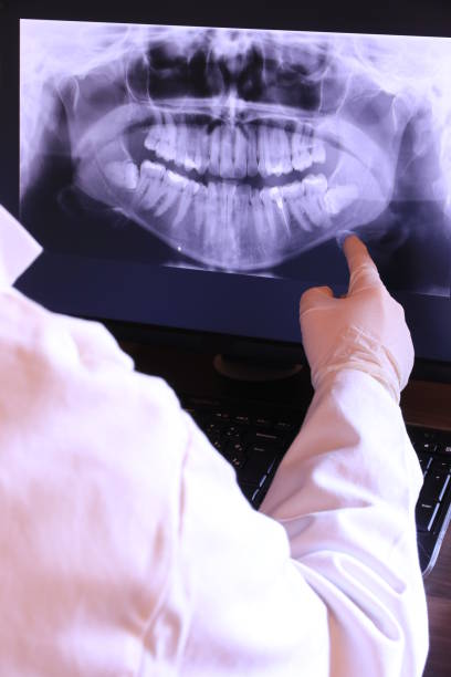 Best Emergency Tooth Extraction in Perrysburg, OH